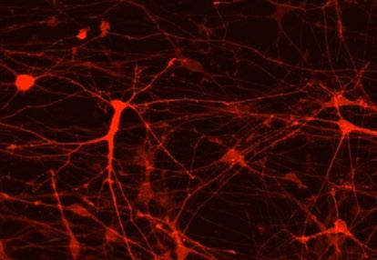 Phase images show neurite length at DIV3 and DIV14.