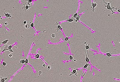 astrocytes.