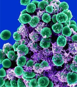 The Six Kingdom System Kingdom Eubacteria eu means true Mostly aerobic (some are anaerobic) unicellular