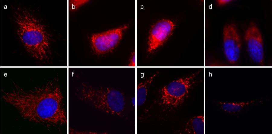 Figure S1. GA induces immediate mitochondrial fragmentation in HeLa cells at higher concentration than in normal human fibroblasts (BJ cells).