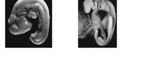 Homology Embryology: Ontogeny