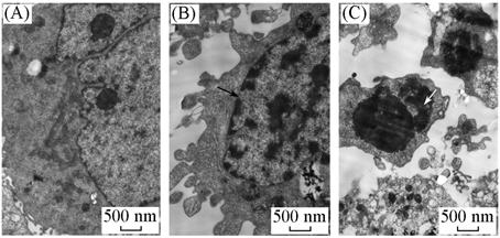 Effects of Hydroxyapatite Nanoparticles on Apoptosis and Invasion of Human Renal Cell Carcinoma 786-0 Cells WANG Zhi-xin, HOU Yi, HAN Wei, WANG Kai-chen, GUO Bao-feng, LIU Ying, CHANG Xi-hua, WANG