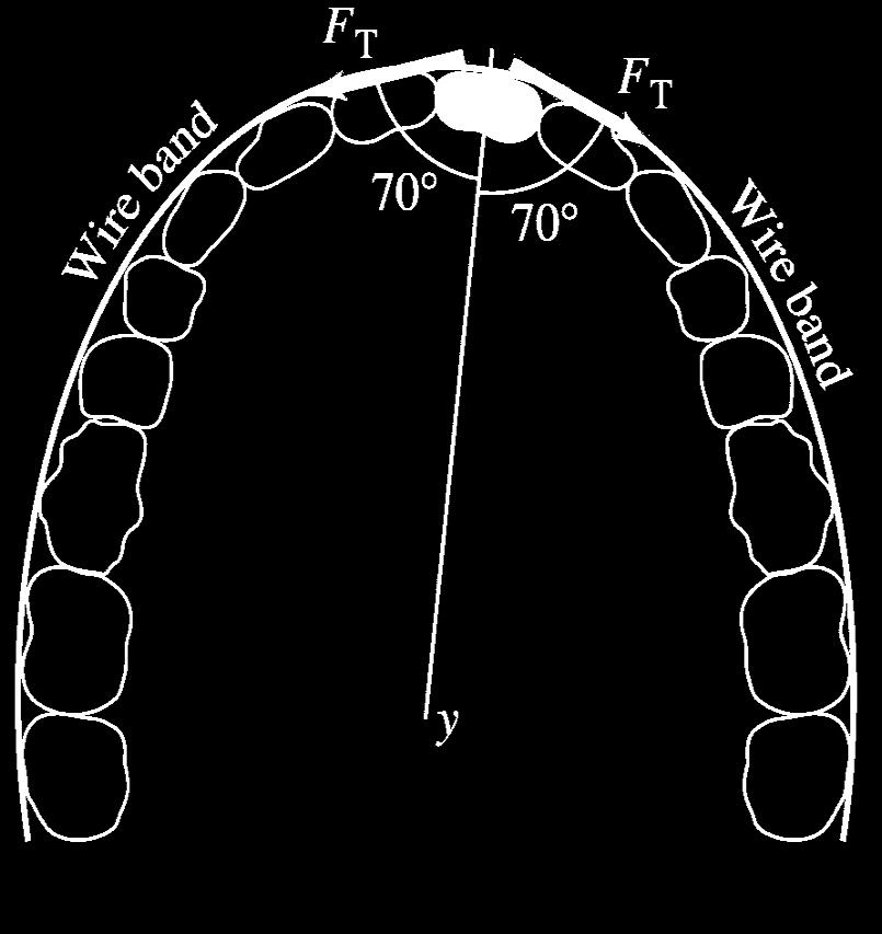 It therefore exerts forces of 2 N on the highlighted tooth (to which it