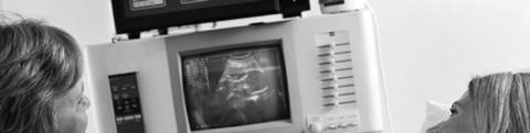 Ultrasound Images Ultrasonic imaging uses