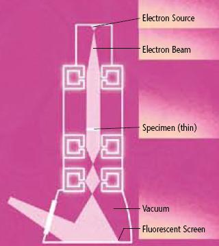 TEM - The transmission electron microscope can be compared with a slide projector.