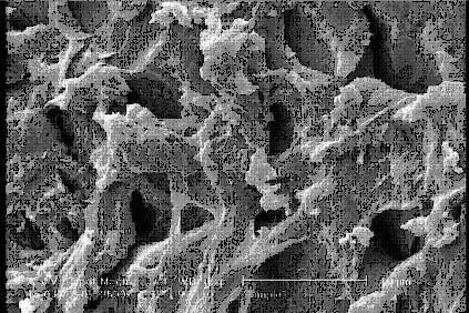 2: SEM photograph of the hydrogel.