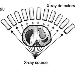 This problem has been resolved by the use of computerised axial tomography which involves the use of computers in conjunction with X-ray machines to produce 3-D images of the body.