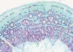 PLANT epidermal forms a protective outer covering vascular transports water & nutrients throughout the