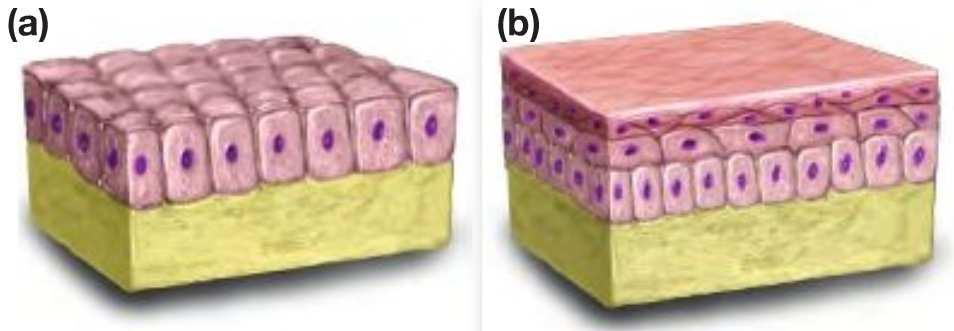 Animal Tissue Epithelial Epithelial tissue (epithelium) is made up of tightly packed cells that cover body surfaces and line the body s internal organs and cavities.