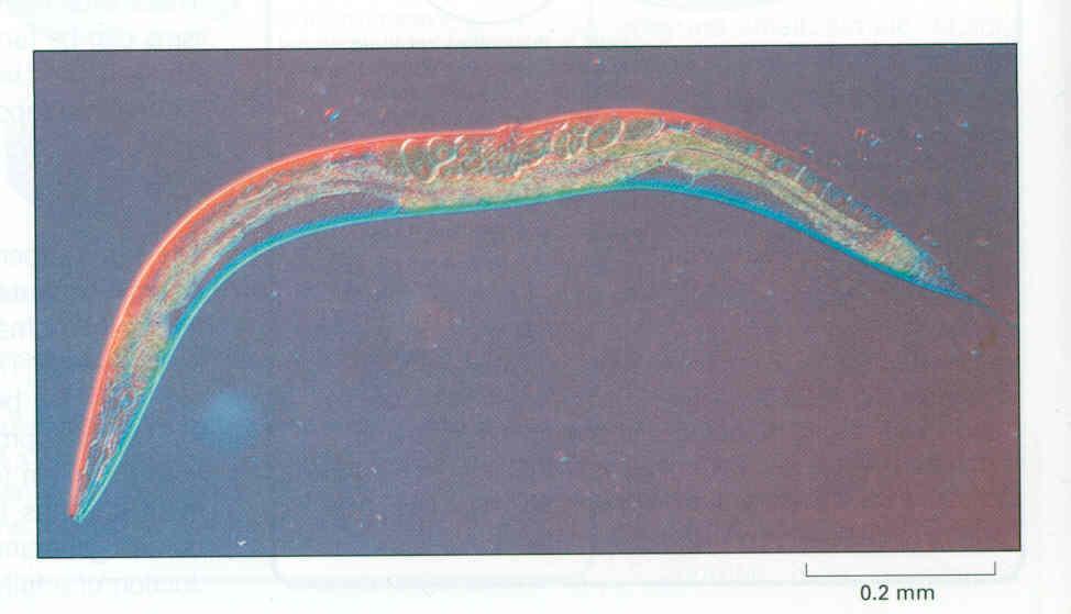 Caenorhabditis elegans: a model organism to