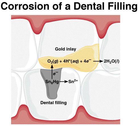 Chemistry In Action: Dental Filling Discomfort 2+ Hg 2