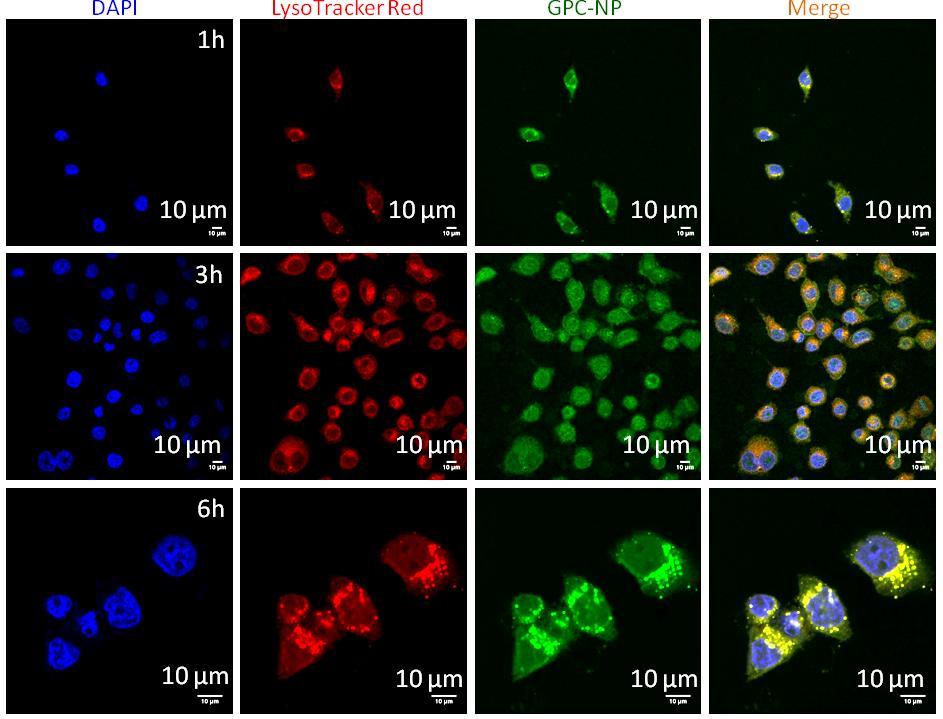Fig. S15: CLSM images of HeLa cells after incubating with GPC-NPs at 1h, 3h and 6h time points.