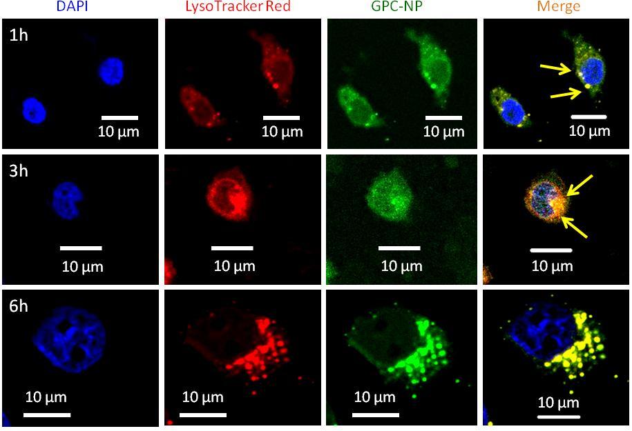 Fig. S16: High resolution CLSM images of HeLa cells after incubating with GPC-NPs at 1h, 3h and 6h time points.