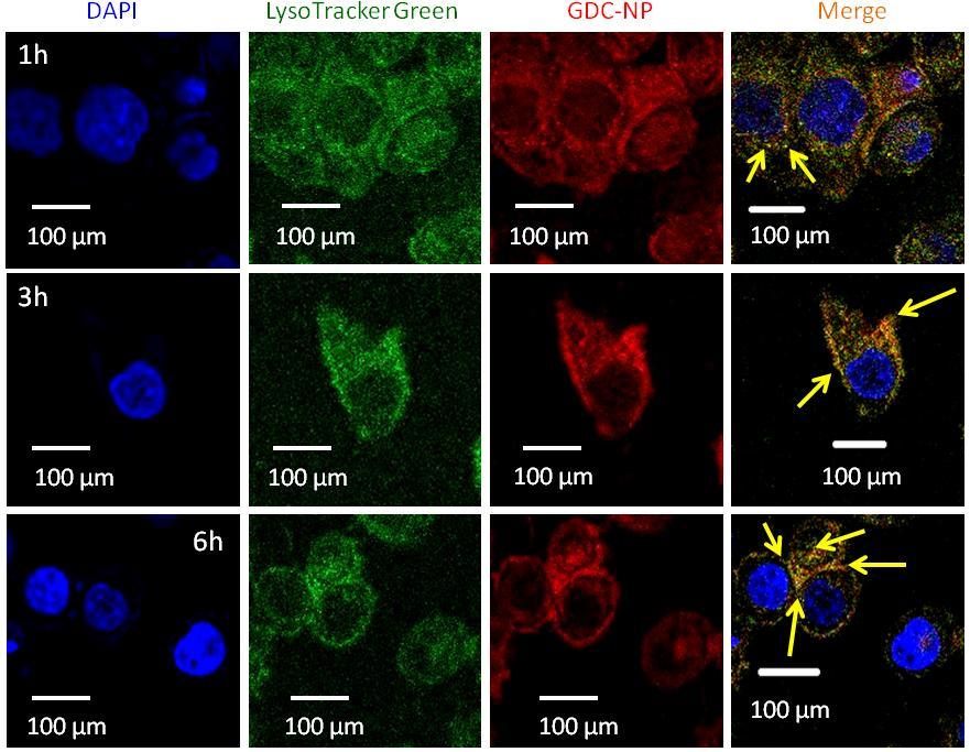 Fig. S18: High resolution CLSM images of HeLa cells after incubating with GDC-NPs at 1h, 3h and 6h time points.