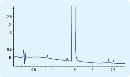54 mau 0.853 - Impurit 1.349 - Impurity A 1.489 - Main comp. 2.393 - Impurity C 2.516 - Impurity B min Figure 49 Fast LC method for the analysis of impurities Column: Zorbax SB-C18, 4.6 x 50 mm, 1.