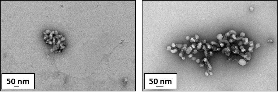 Figure S7. Representative TEM images of copolymer nanoparticles present in the dried aqueous supernatant obtained after the centrifugation of a mixture of 1.
