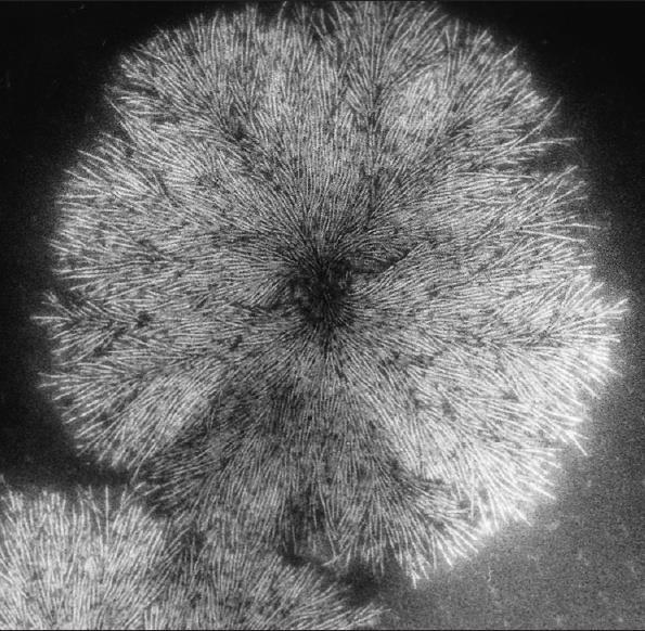 Transmission electron micrograph(tem) showing the spherulite structure in a natural rubber specimen.