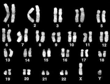 C. Connection: Karyotypes A Karyotype is a photograph taken of a cell during mitosis or meiosis. From that image the individual chromosomes can be separated and organized into pairs.