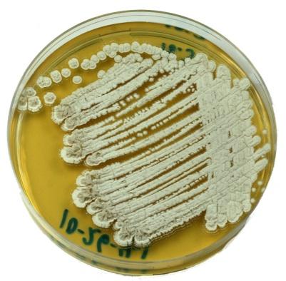 Isolation and characterization of Streptomyces species from potato
