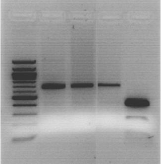 Streptomyces species determination Streptomyces species determination is based on sequence-variable regions in the 16s ribosomal RNA gene S. scabies and S.