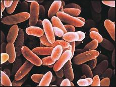 Classify the shape of the bacterium Streptococcus by looking at the names of the bacteria pictured. Structure and Function A bacterium contains cytoplasm surrounded by a cell membrane and a cell wall.