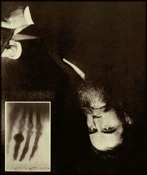 X-Ray Discovery: Roentgen Wilhelm Roentgen ca. 1895.