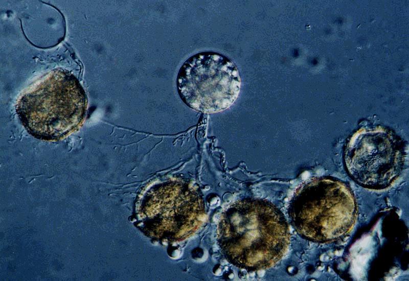 CHYTRIDIOMYCOTA Called chytrids Produce motile spores (flagella) Mostly saprobes and