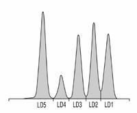 Electrophoresis examples from clinical medicine separation of serum proteins, isoenzymes, nucleic acids immunoelectrophoresi s