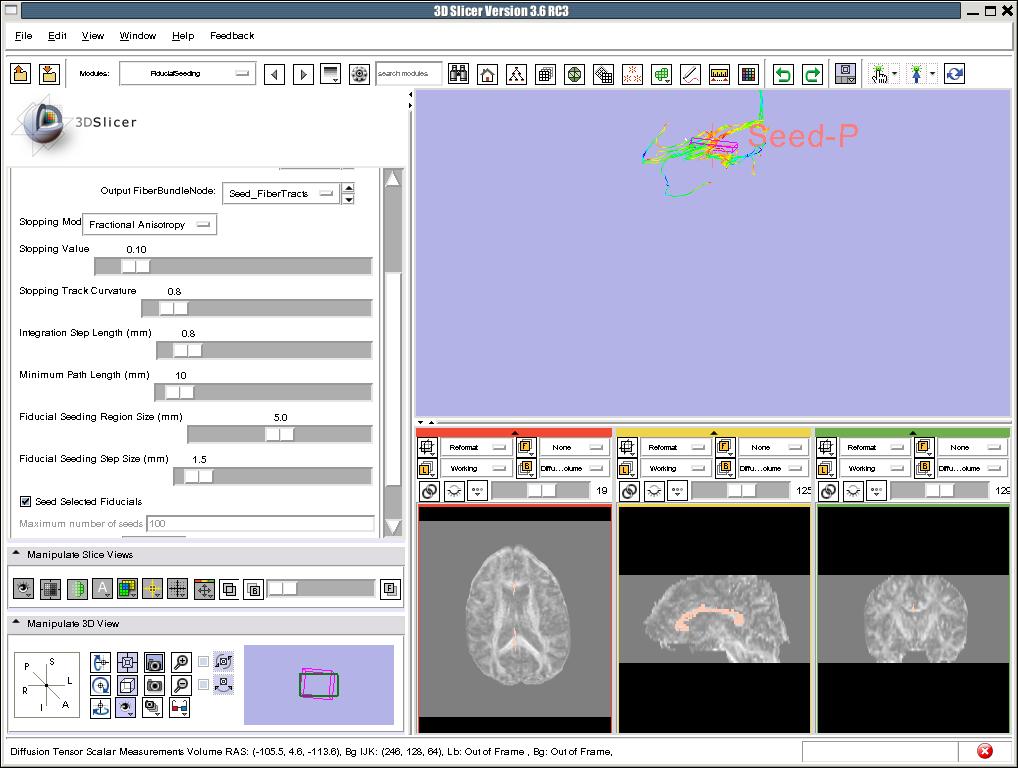 Fiducial Seeding Set the Stopping Mode to Fractional Anisotropy and set the tractography parameters to the values that we used for the