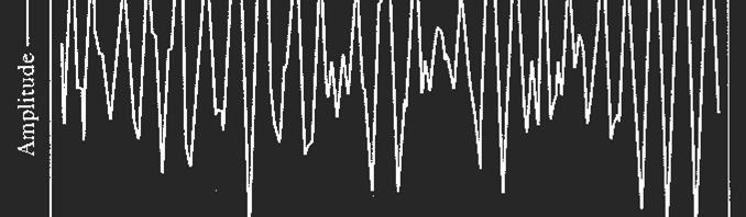 WAVEFORMs for /a/ & /sh/ 1. Which is which? 2.