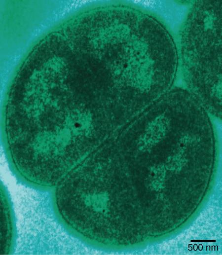 OpenStax-CNX module: m61908 8 Figure 5: Deinococcus radiodurans, visualized in this false color transmission electron micrograph, is a prokaryote that can tolerate very high doses of ionizing