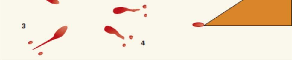 ) are used to properly assess blood splatter.