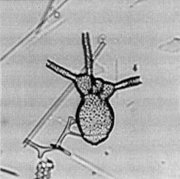 151 Acrobotrys tritubus Riedel Acrobotrys tritubus Riedel, 1957, p.80, pl.1, fig.