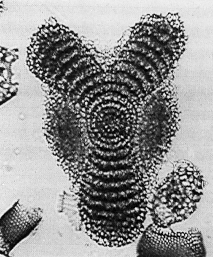 Amphirhopalum ypsilon Haeckel 153 Amphirhopalum ypsilon Haeckel, 1887, p.522; Nigrini, 1967,p.35, pl.3, figs.