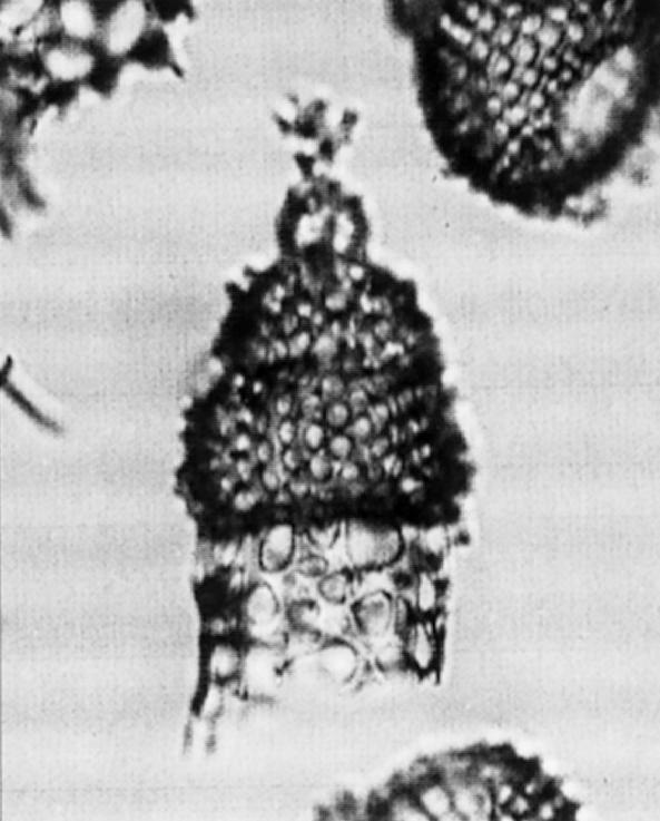 159 Artophormis gracilis Riedel Artophormis gracilis Riedel, 1959, p.300, pl.2, figs.12-13; Riedel and Sanfilippo, 1970, p.532, pl.13, fig.6; 1971, pl.3b, figs.5-7, pl.3b, figs.5-7, pl.6, fig.