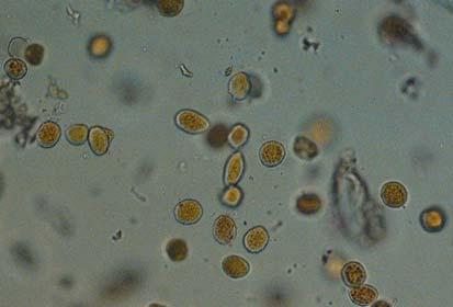 Rusts have complex life cycles that involve alternate hosts and several spores stages.