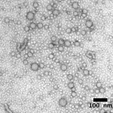 Fig. S8. TEM image of polydma 34 -b-poly(dma 14 -co-aa 6 )-b-polynipam 49 crosslinked nanoparticles prior to dialysis. (scale bar = 100 nm, 2% uranyl acetate aqueous solution negative stain).