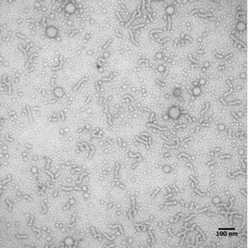Fig. S10. TEM image of polydma 34 -b-poly(dma 14 -co-aa 6 )-b-polynipam 61 crosslinked nanoparticles prior to dialysis. (scale bar = 100 nm, 2% uranyl acetate aqueous solution negative stain).