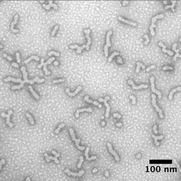 Fig. S12. TEM image of polydma 34 -b-poly(dma 14 -co-aa 6 )-b-polynipam 73 crosslinked nanoparticles prior to dialysis. (scale bar = 100 nm, 2% uranyl acetate aqueous solution negative stain).