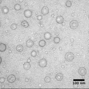 Fig. S16. TEM image polydma 34 -b-poly(dma 14 -co-aa 6 )-b-polynipam 121 crosslinked nanoparticles prior to dialysis. (scale bar = 100 nm, 2% uranyl acetate aqueous solution negative stain).