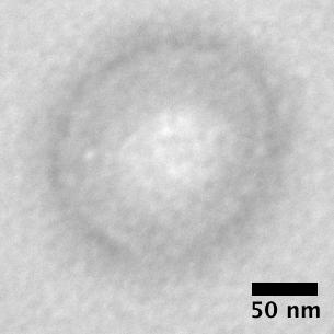 Transmission electron microscopy with an osmium tetroxide positive stain showed the vesicle nanoparticle bilayer