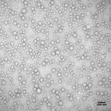 Fig. S6. TEM image of polydma 34 -b-poly(dma 14 -co-aa 6 )-b-polynipam 38 crosslinked nanoparticles prior to dialysis. (scale bar = 100 nm, 2% uranyl acetate aqueous solution negative stain).