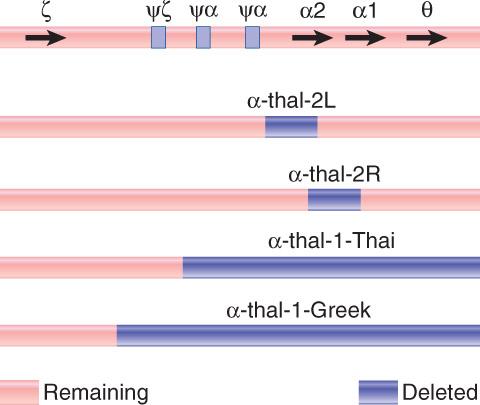 Different thalassaemias are caused by various deletions that eliminate α- or β-globin genes.