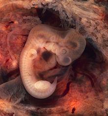 This is a human embryo at a stage of its development called a blastocyst. There is no differentiation or specialization of cells at this point of development.
