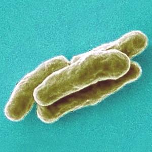 Identifying Prokaryotes: Metabolic Diversity Mycobacterium tuberculosis Cyanobacteria Deep Oceanic Vent Tube Worm Bacteria Chemoheterotroph Photoautotroph Chemoautotroph The two general requirements