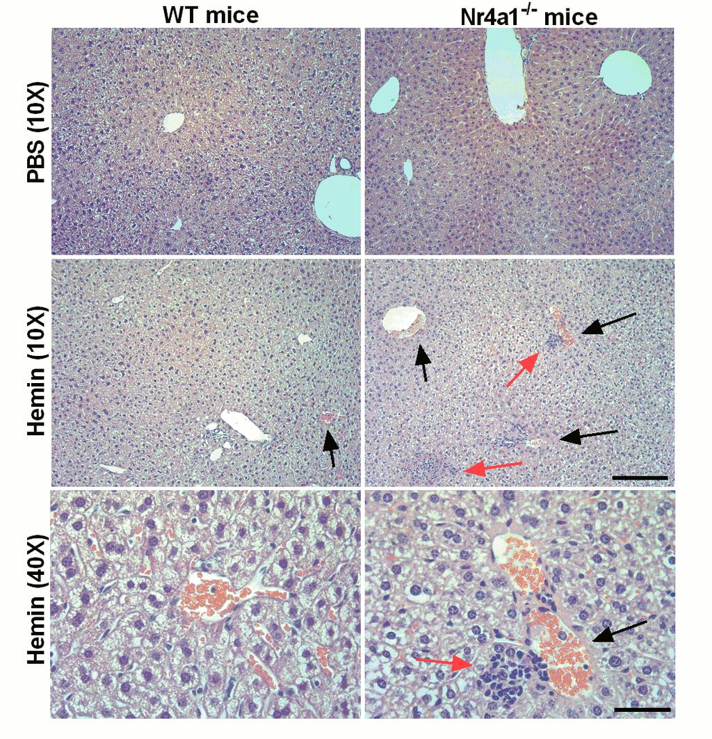In Vivo Effects of Sickle RBCs and Hemin in Nr4a1-/- mice WT P K H -26 la b e le d s ic k le R B C Im m u n