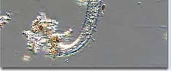 org/entry/protozoa http://micro.magnet.