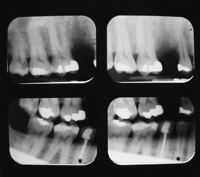 5 Dental X-ray images are useful for diagnosing problems with teeth. 4 X-ray radiation is ionising, so people who work with it are at risk of developing cancer.