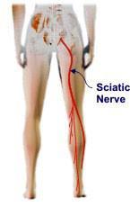 Large Cells Sciatic Nerve WARNING: Graphic picture next