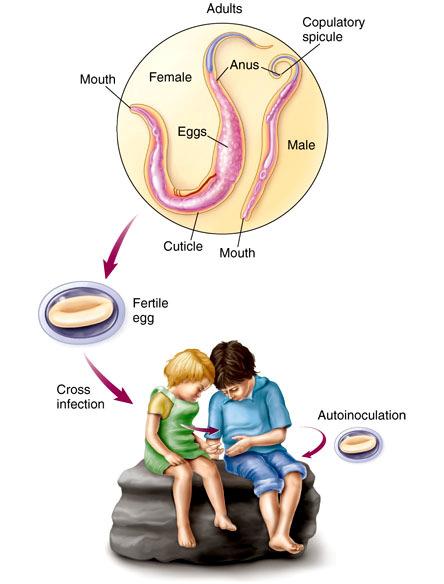 Roundworms -The pinworm life cycle in the human host In this scenario